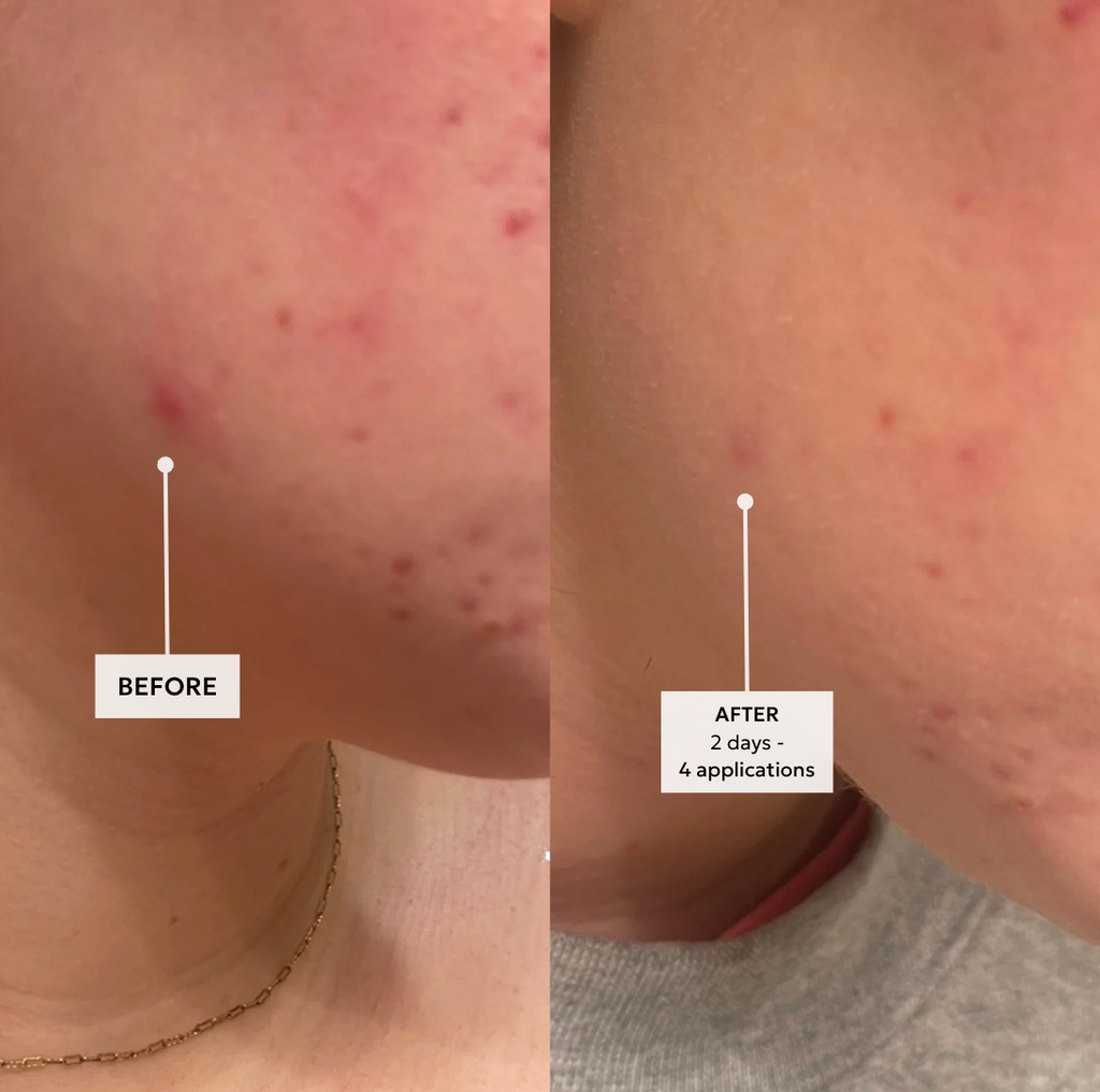Anti Bump Solution