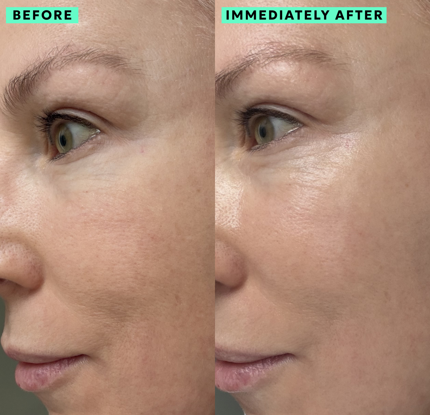 roche glutathione iv Renée Rouleau Professional Skin Care