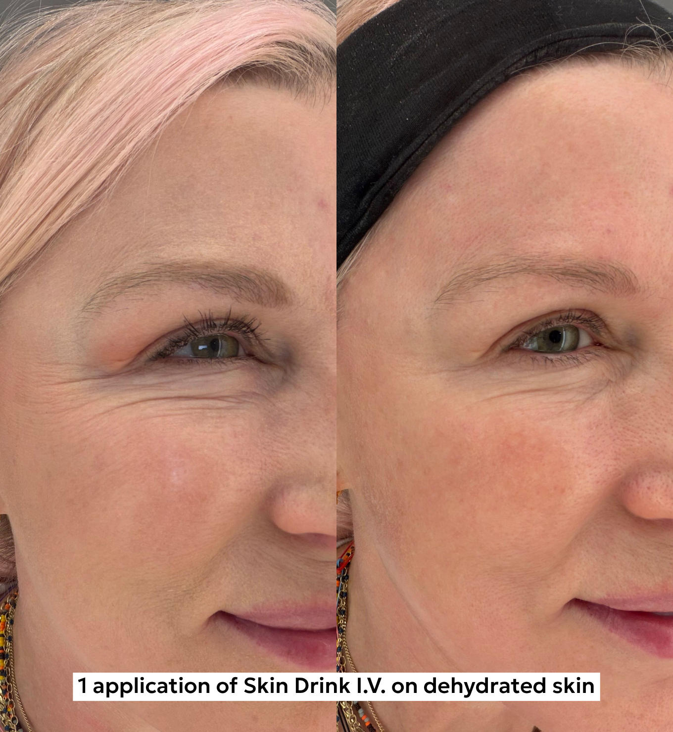 Skin Drink I.V.