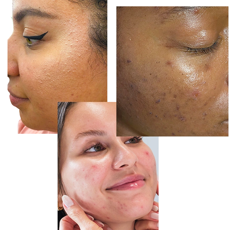 SKIN-TYPE-3.webp__PID:54364cc6-a552-4120-9816-32b9791f6c0a