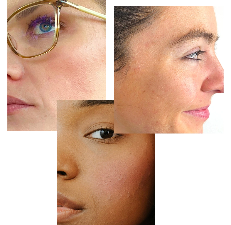 SKIN-TYPE-4.webp__PID:9cd0fa55-1834-4a4c-b28d-ac8efee851c6