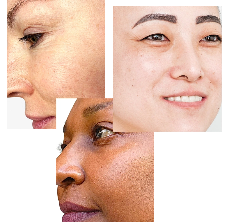 SKIN-TYPE-6.webp__PID:89365917-856d-4194-be27-49c12f6a4355