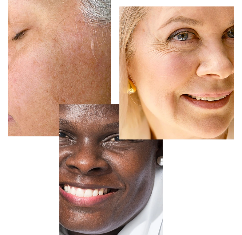 SKIN-TYPE-8.webp__PID:8e0cca5a-cf48-4530-a611-1eeb11253870