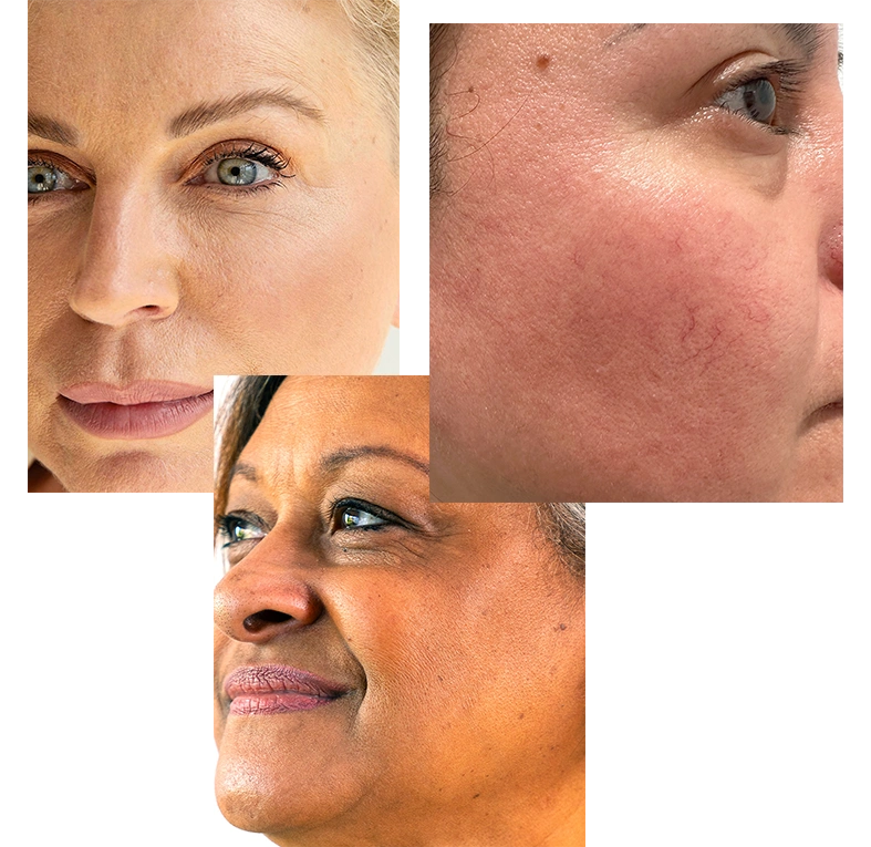 SKIN-TYPE-9.webp__PID:2d416509-ac78-4668-9b84-0093e81830af