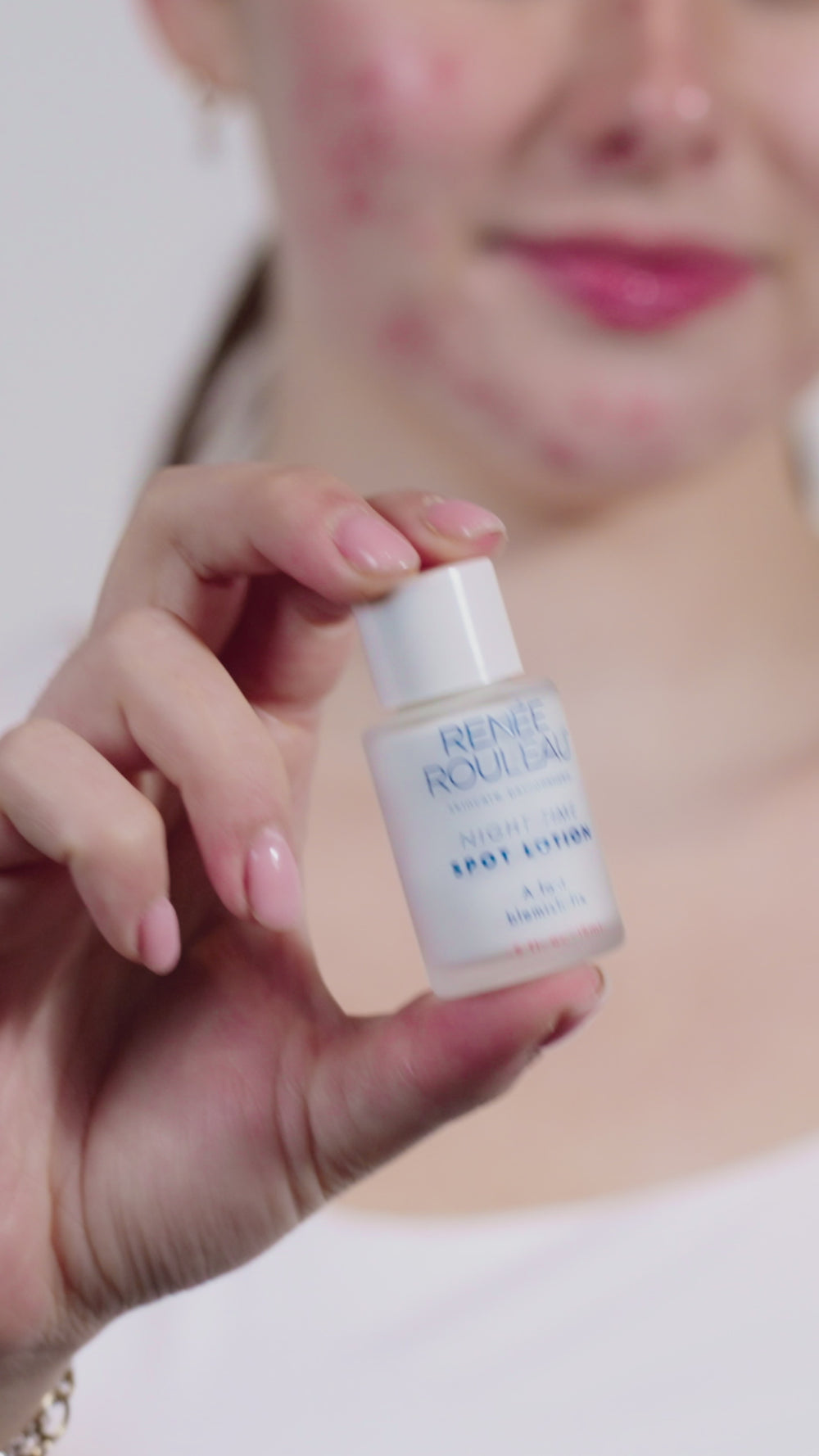 Night Time Spot Lotion Video