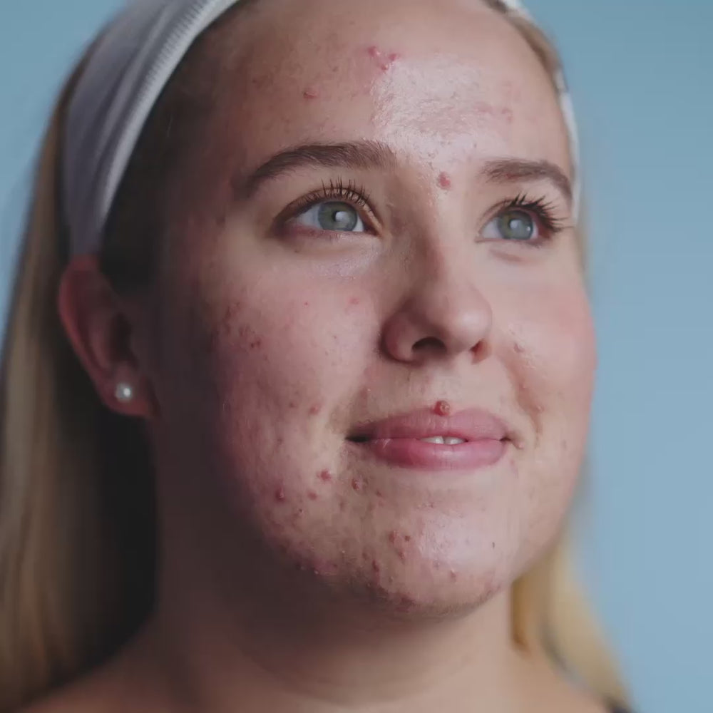 Dual Enzyme Softening Peel Video