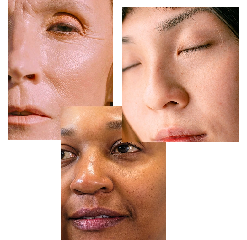 skin-type-7.webp__PID:cb8f96e2-ddcd-4f98-a02f-d307d9363a4c