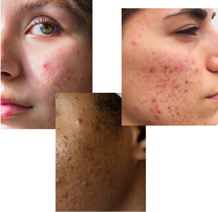 skintype1.png__PID:7ba6279a-07f1-480f-8059-1a80935e9c5e